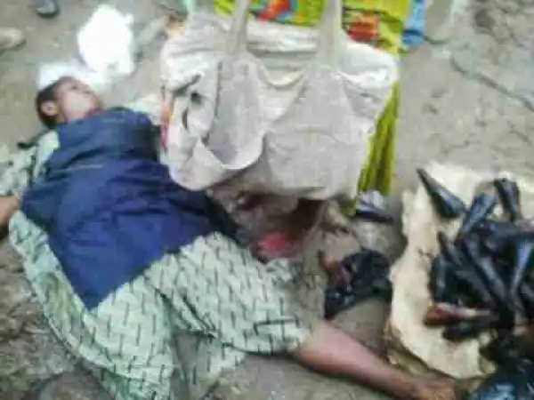 Smoked Fish Seller Beaten To Coma In Benin By Obaseki Boys (Photos)